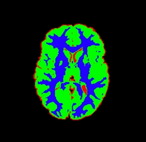Graph Cuts, <i>Caveat Utilitor</i>, and Euler's Bridges of Konigsberg