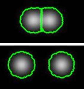 Cell Tracking using Coupled Active Surfaces for Nuclei and Membranes