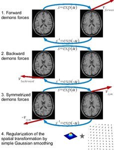 An ITK Implementation of the Symmetric Log-Domain Diffeomorphic Demons Algorithm
