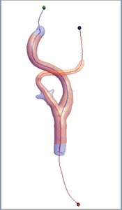 A Minimal Cost Path and Level Set Evolution Approach for Carotid Bifurcation Segmentation