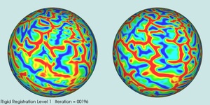 Spherical Demons Registration of Spherical Surfaces