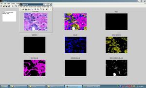Fuzzy Magnetic Color Image Segmentation and Advanced Edge Detection