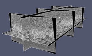 An Open Source, Fast Ultrasound B-Mode Implementation for Commodity Hardware